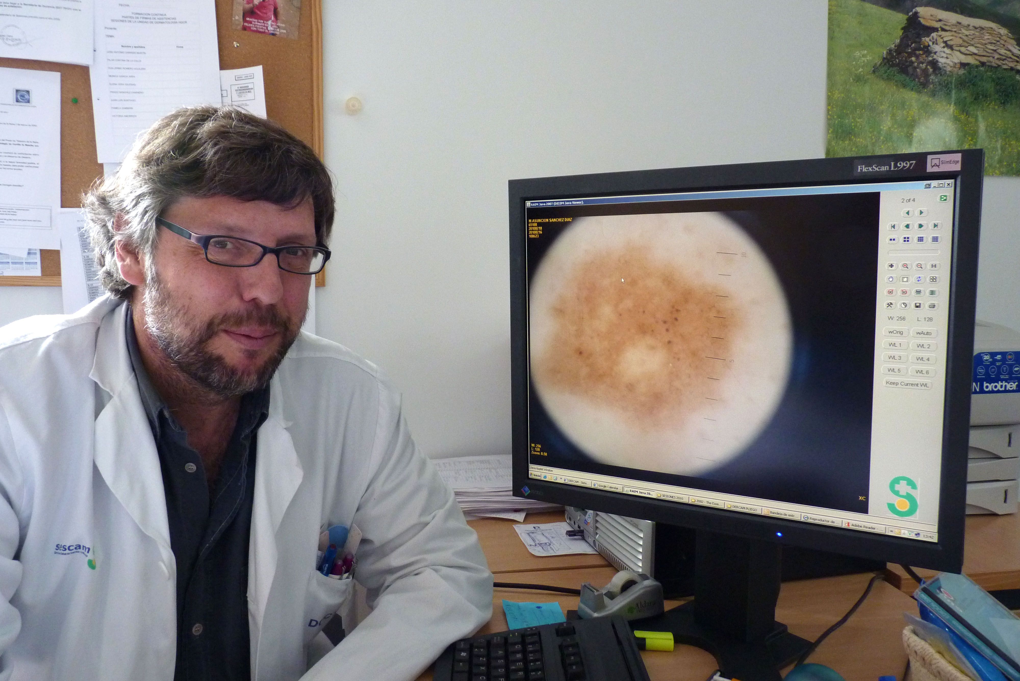 El Gobierno de Castilla-La Mancha completa la implantación del programa de teledermatología en todos los hospitales