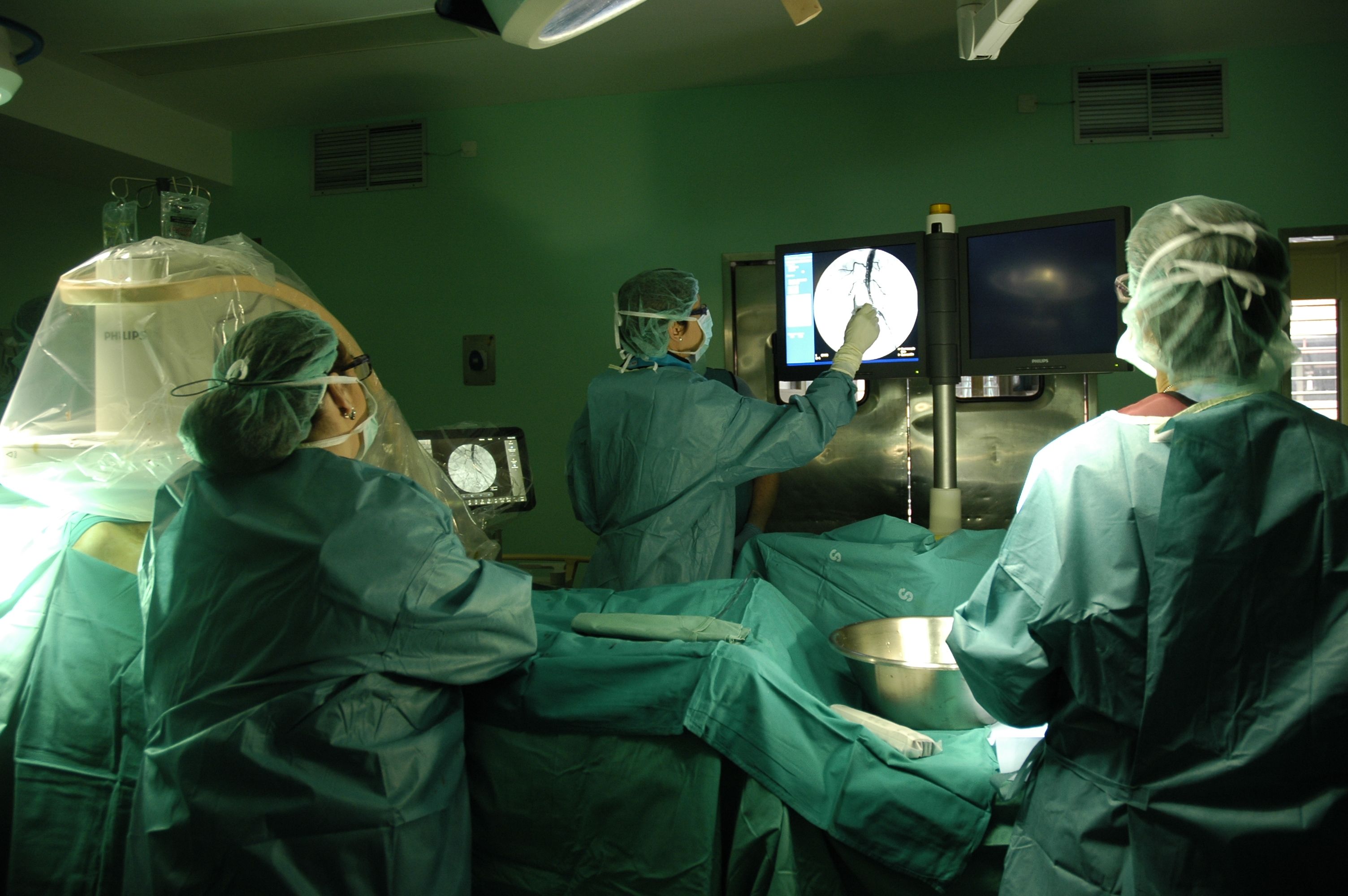 El servicio de Angiología y Cirugía Vascular del Hospital de Guadalajara tiene ya un nuevo arco radioquirúrgico