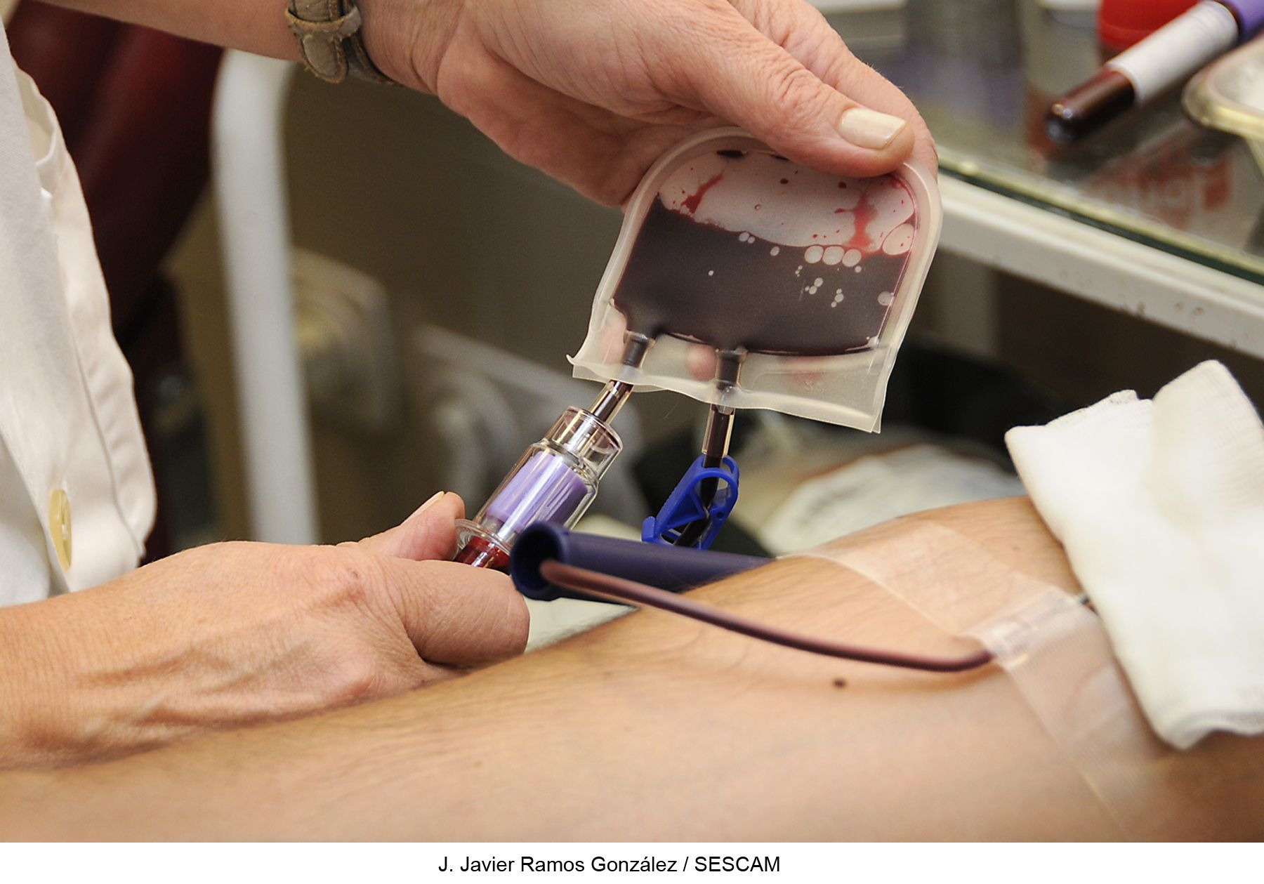 253 personas se inscribieron en 2016 en Guadalajara en el Registro de Donantes de Médula Ósea, más del doble que el año anterior