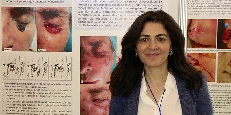 Un trabajo sobre reconstrucción de párpado inferior realizada en el Hospital de Guadalajara, premiado en el Congreso Nacional de Dermatología