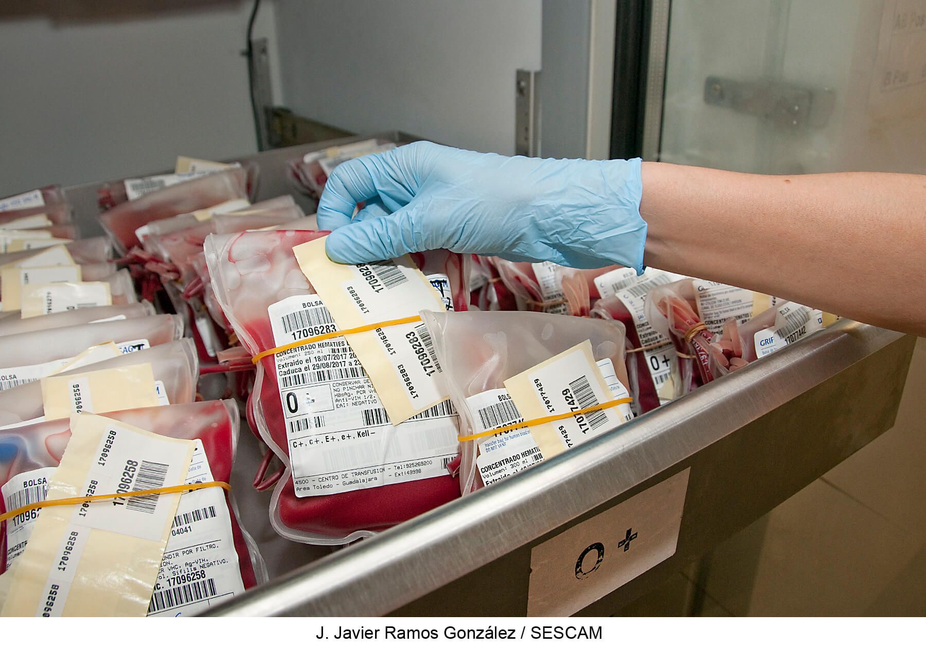 El Banco de Sangre de Guadalajara hace un llamamiento para la donación en agosto