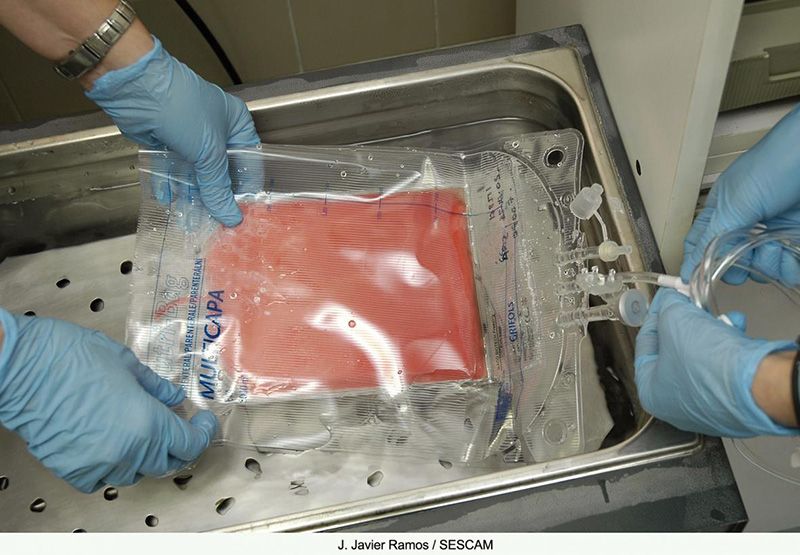 Castilla-La Mancha ha duplicado el número de donantes incluidos en el registro de médula ósea en lo que va de año