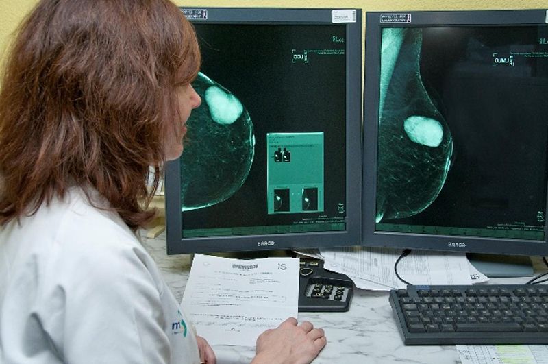 El 86,6% de las mujeres citadas en Cuenca ha participado en el programa de detección precoz de cáncer de mama; en Guadalajara sólo el 72%