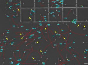 La UCLM ha participado en el desarrollo de un software que permite evaluar la movilidad espermática