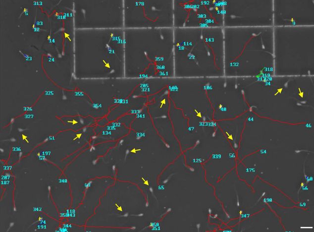 La UCLM ha participado en el desarrollo de un software que permite evaluar la movilidad espermática