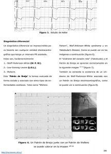 Palpitaciones que te despiertan por la noche, sudoración nocturna, bajos niveles de litemia.... Puedes sufrir el patrón electrocardiográfico Breijo