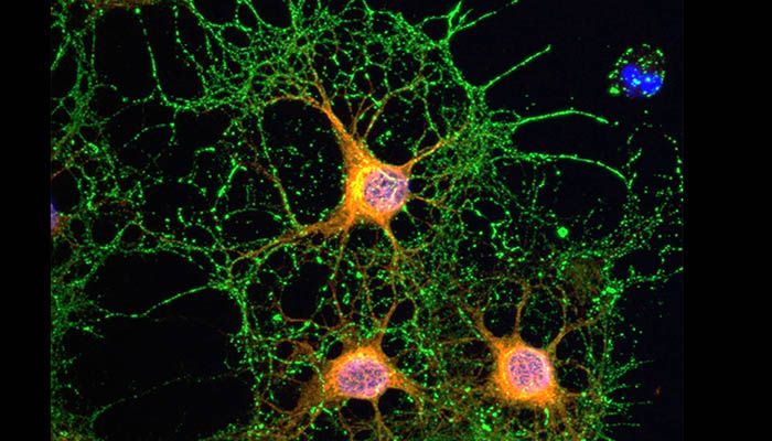 Un estudio de la UCLM y Parapléjicos incide en el papel del sistema cannabinoide en la reparación del daño neuronal
