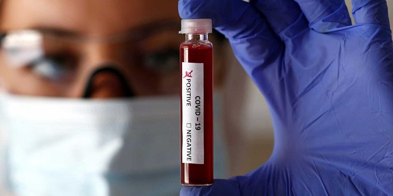 CCOO-CLM solicita al Gobierno regional información sobre criterio de reparto de material y tests rápidos de coronavirus 1 CCOO-CLM solicita al Gobierno regional información sobre criterio de reparto de material y tests rápidos de coronavirus