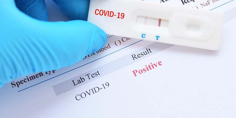 El Consejo Autonómico de Enfermería rechaza la propuesta de los farmacéuticos de hacer test de la Covid-19 en las oficinas de farmacia