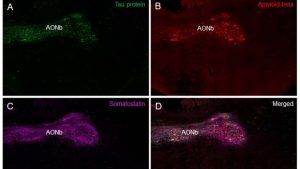 Investigadores de la UCLM concluyen que hay zonas del sistema olfativo comunes en el desarrollo de las enfermedades de Alzheimer y Parkinson