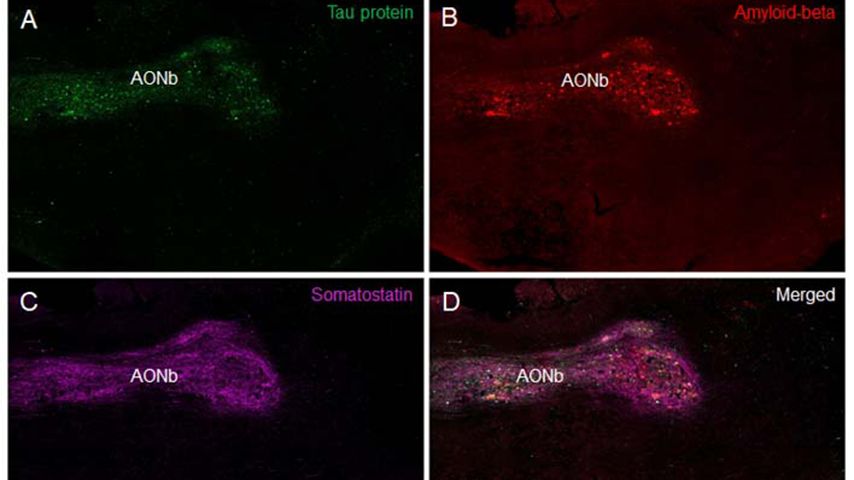 Investigadores de la UCLM concluyen que hay zonas del sistema olfativo comunes en el desarrollo de las enfermedades de Alzheimer y Parkinson