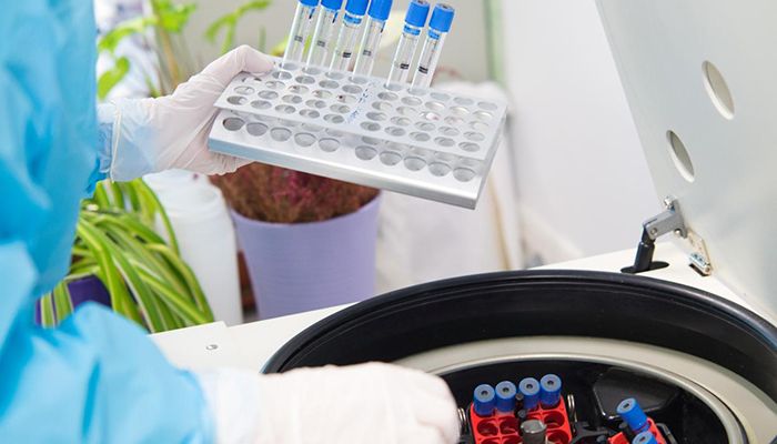 Viernes 31 de julio Guadalajara registra un fallecimiento por coronavirus y suma seis nuevos casos y Cuenca, uno más