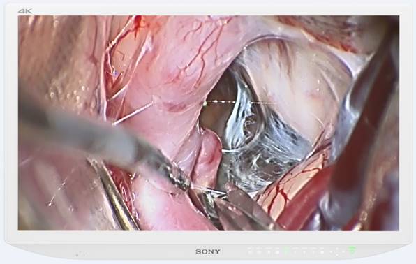 Sony presenta el monitor para uso médico de alto rendimiento LMD-X3200MD