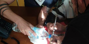 Los bomberos de Motilla liberan el dedo de un niño atrapado en un rodamiento