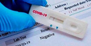 Los técnicos sanitarios avisan Los resultados de los test rápidos de anticuerpos no sirven para diagnosticar infección activa por SARS-CoV-2