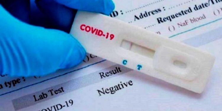 Los técnicos sanitarios avisan Los resultados de los test rápidos de anticuerpos no sirven para diagnosticar infección activa por SARS-CoV-2