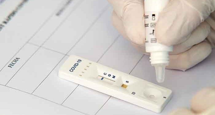 Sanidad decreta medidas especiales nivel 3 en Horcajo de Santiago 1 Sanidad decreta medidas especiales nivel 3 en Horcajo de Santiago