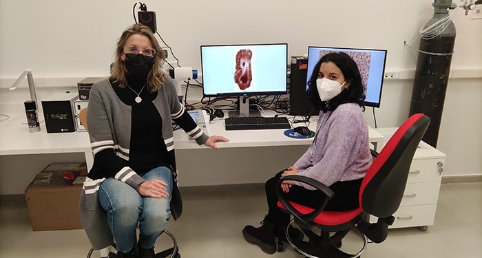 Un estudio del grupo de Neuroplasticidad y Neurodegeneración de la UCLM describe que el Parkinson afecta de forma desigual según el sexo