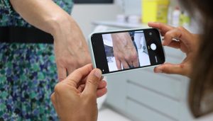Más de 62.000 pacientes se han beneficiado de las ventajas que ofrece el programa de teledermatología implantado en toda la región hace un año
