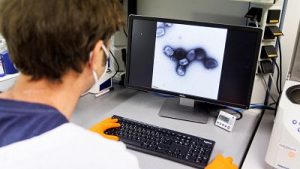 Castilla-La Mancha registra el primer caso de viruela de mono