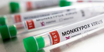Castilla-La Mancha registra el segundo caso de viruela de mono