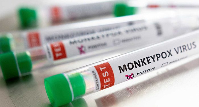 Castilla-La Mancha registra el segundo caso de viruela de mono 1 Castilla-La Mancha registra el segundo caso de viruela de mono