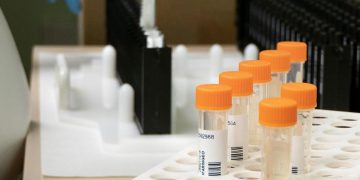 Castilla-La Mancha registra once nuevos casos de viruela del mono del 22 al 28 de julio