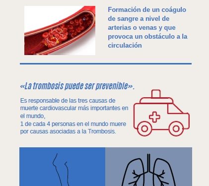 El Hospital de Guadalajara apoya la celebración del Día de la Trombosis con la instalación de mesas para informar a la ciudadanía y contribuir a su prevención 1 El Hospital de Guadalajara apoya la celebración del Día de la Trombosis con la instalación de mesas para informar a la ciudadanía y contribuir a su prevención
