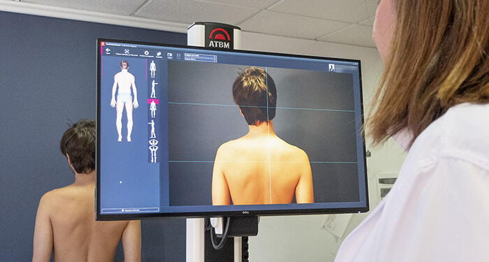 El servicio de Dermatología de Guadalajara cuenta ya de un equipo con el que realizar un mapeo corporal total de nevus en personas de alto riesgo