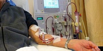 Siete pacientes de Guadalajara se han entrenado para que puedan dializarse en su domicilio