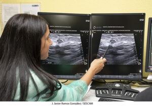 El Hospital de Guadalajara introduce la termoablación con microondas para tratar tumores de mama en mujeres que no pueden ser operadas