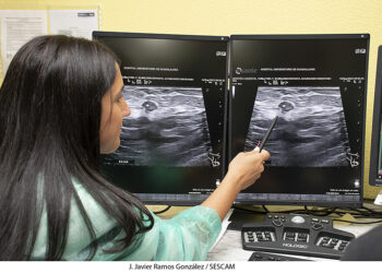 El Hospital de Guadalajara introduce la termoablación con microondas para tratar tumores de mama en mujeres que no pueden ser operadas