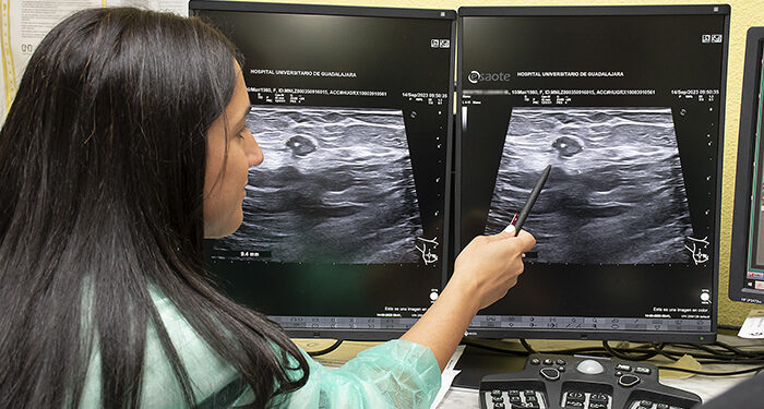 El Hospital de Guadalajara introduce la termoablación con microondas para tratar tumores de mama en mujeres que no pueden ser operadas
