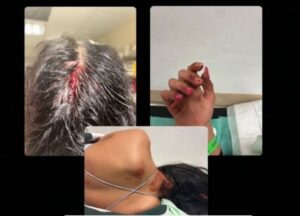 Brutal agresión a tres personas en el merendero de Chillarón hay un detenido