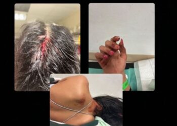Brutal agresión a tres personas en el merendero de Chillarón: hay un detenido