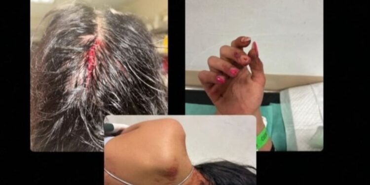 Brutal agresión a tres personas en el merendero de Chillarón hay un detenido