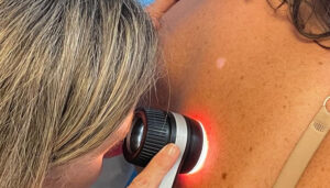 Los pacientes de Castilla-La Mancha esperan la mitad de tiempo que la media nacional para una consulta presencial con el dermatólogo