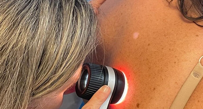 Los pacientes de Castilla-La Mancha esperan la mitad de tiempo que la media nacional para una consulta presencial con el dermatólogo