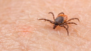 Castilla-La Mancha confirma el primer caso de fiebre hemorrágica de Crimea-Congo en la región