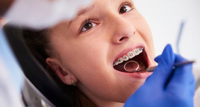 Ortodoncia invisible Spark en Torre del Mar 1 Ortodoncia invisible Spark en Torre del Mar