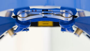 Una revolución silenciosa en la cirugía ocular 2 Una revolución silenciosa en la cirugía ocular