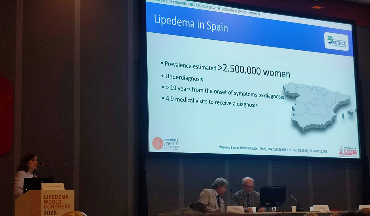 El Servicio de Medicina Física y Rehabilitación del Hospital Universitario de Cuenca participa en el Congreso Mundial de Lipedema celebrado en Roma 2 El Servicio de Medicina Física y Rehabilitación del Hospital Universitario de Cuenca participa en el Congreso Mundial de Lipedema celebrado en Roma